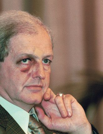 Bárándy Péter 2003-ban, emlékezetes vadászbalesete után, amikor puskájának a tusa arcába csapódott, a visszacsapódó távcső pedig két szemöldöke közt sebezte meg a minisztert. Fotó: alfahir.hu