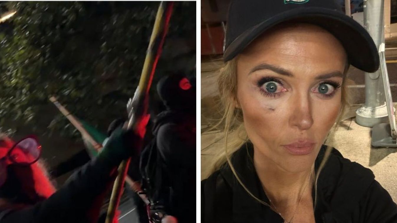 Katie Daviscourt-ot súlyosan megverte egy antifa nő az ICE-ellenes tüntetés során. Fotó: X/The Post Millennial