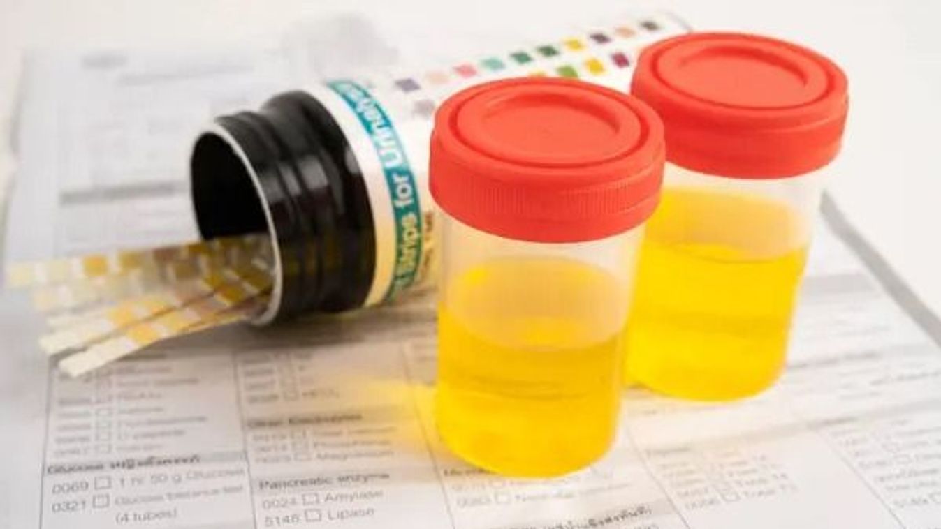 A kampány nagy pisitesztjére vár az egész ország?