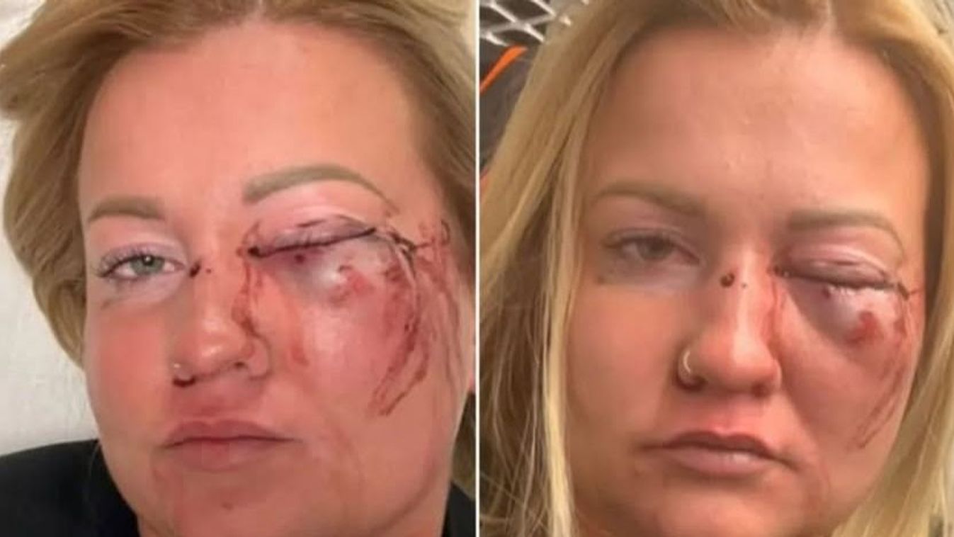 Nem fideszes a nőverő alpolgármester, mégis ezt terjeszti a baloldal