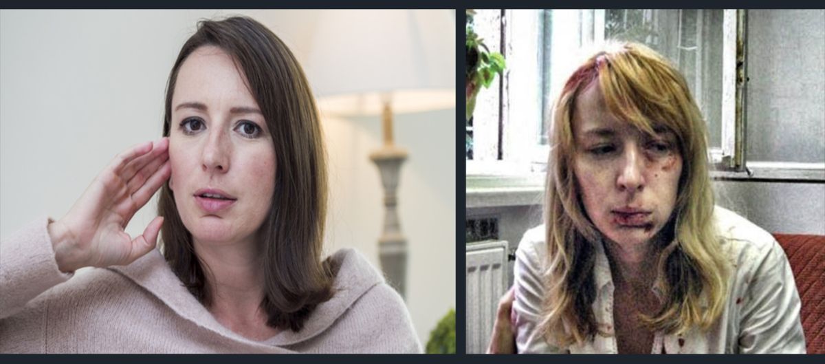 Malina Hedvig, magyarellenes